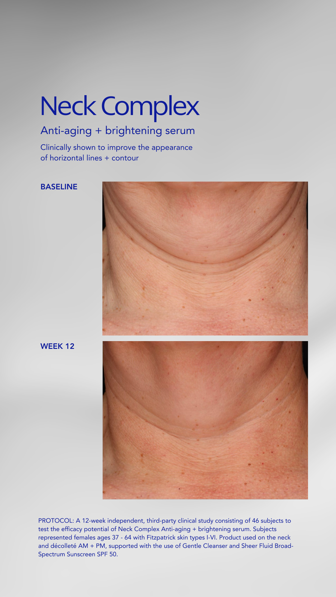 Neck Complex